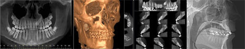 I-CAT Digital Dental Imaging System